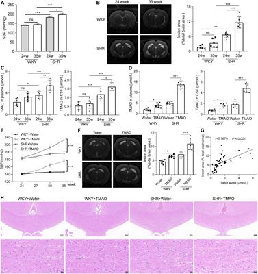 Trimethylamine N-oxide promotes demyelination in spontaneous hypertension rats through enhancing pyroptosis of oligodendrocytes